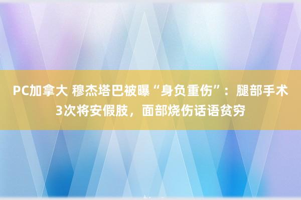 PC加拿大 穆杰塔巴被曝“身负重伤”：腿部手术3次将安假肢，面部烧伤话语贫穷